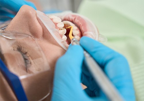 Patient in Medina Valley getting their teeth cleaned
