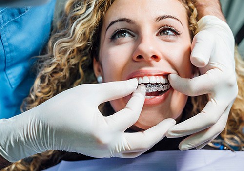Dentist in white gloves inserting Invisalign over woman’s upper arch