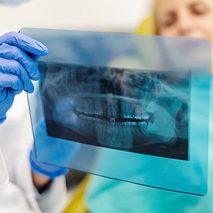 Dentist and patient reviewing X-ray together